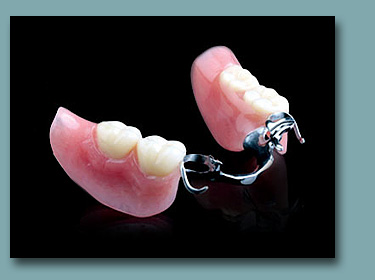 Partial Denture Image